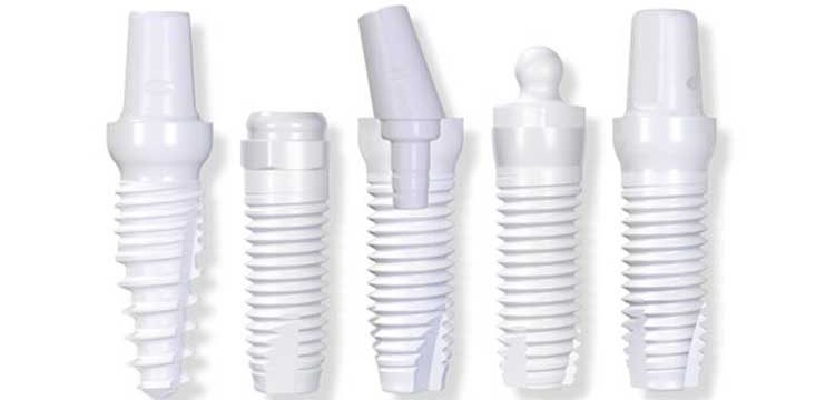 titanium-dental-implants-vs-zirconia-implants-750x360.jpg